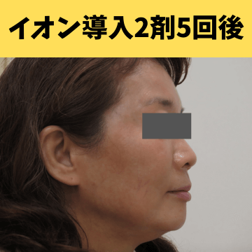 施術後