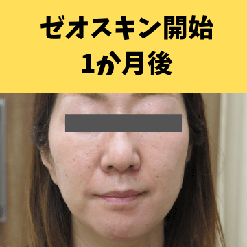 施術後