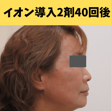 施術後