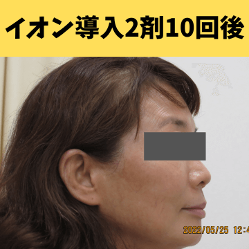 施術後