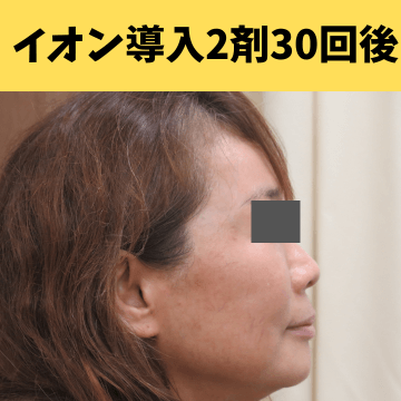 施術後