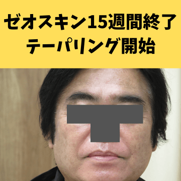 施術後