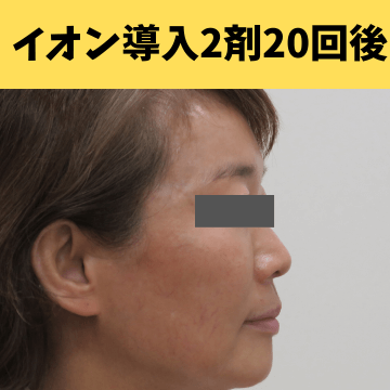 施術後