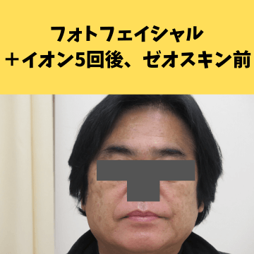 施術後