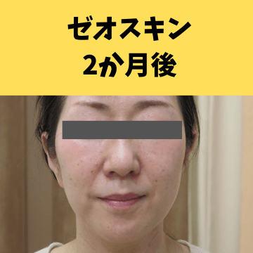 施術後